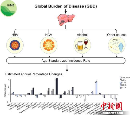 中国学者率先系统解析全球不同地区肝癌发病模式