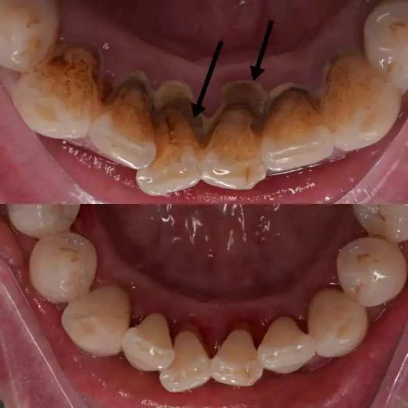 作者供图)   再说了   牙齿表面的牙釉质非常坚硬   是人体最硬的部位