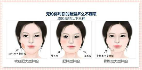因下颌角部分脂肪堆积而造成的脸大脸胖;1.