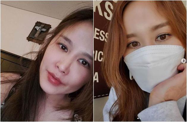 韩国女星蔡丽娜自曝整形后遗症:没办法戴口罩