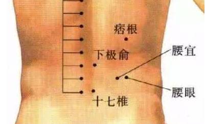 天天有中医|痛经的特效穴 你知道吗