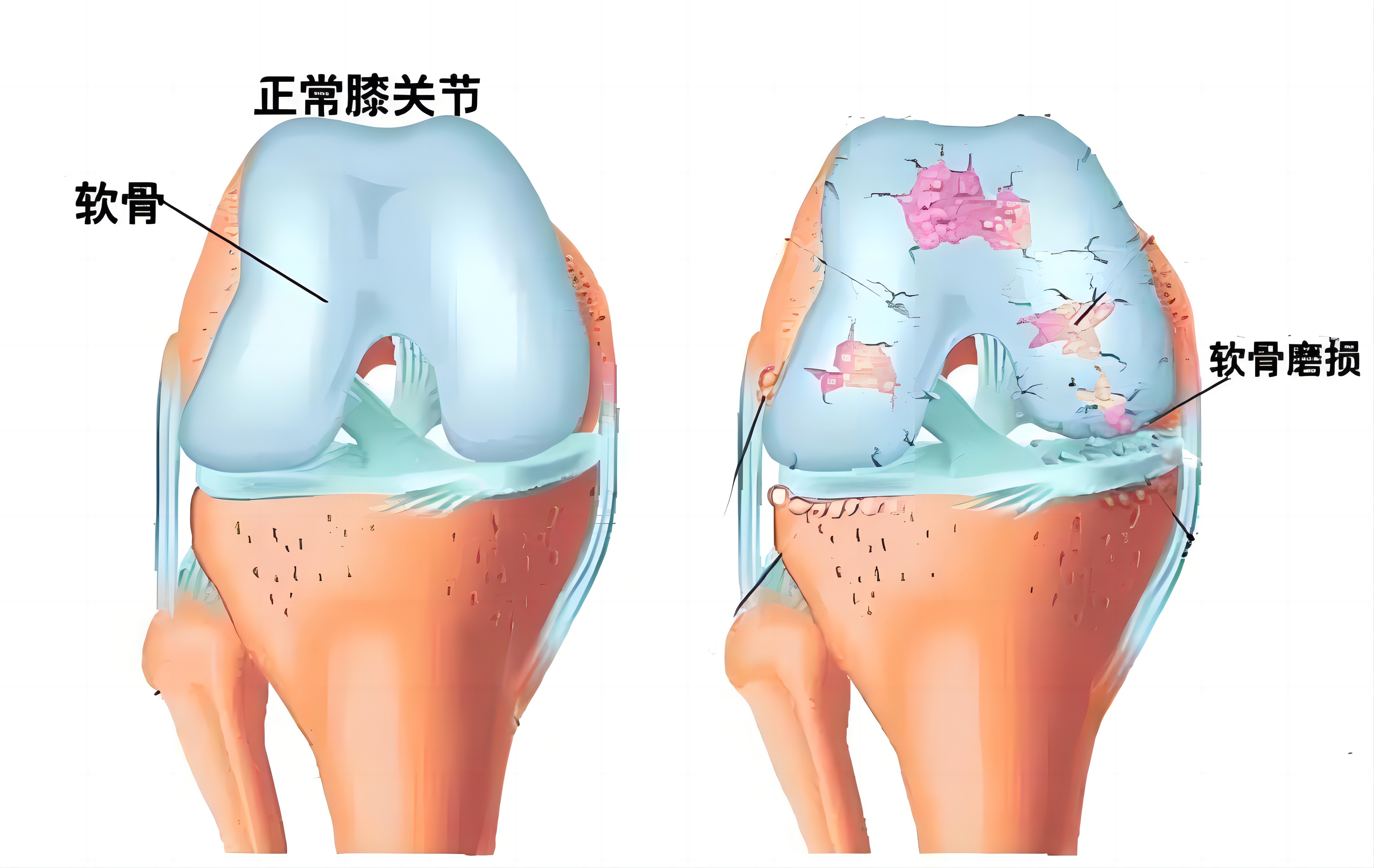 健8-11图2.jpg