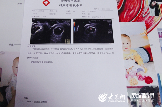 怀孕超声报告单图片