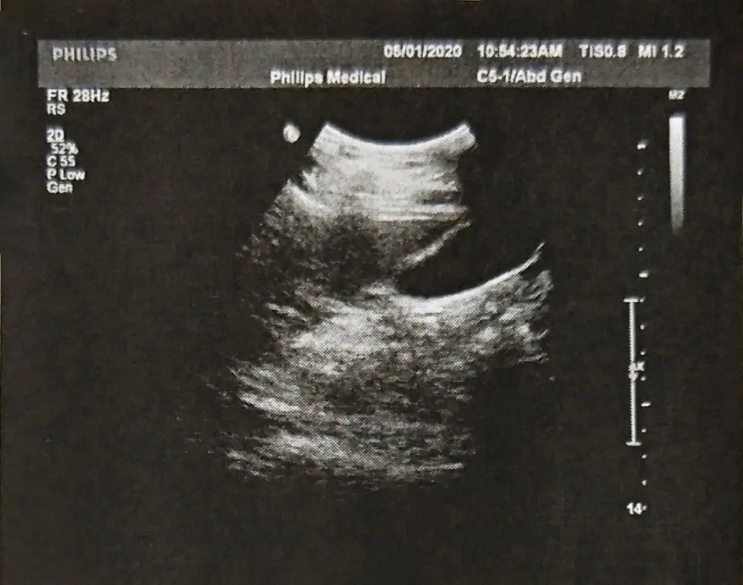 一个月怀孕化验单图片图片
