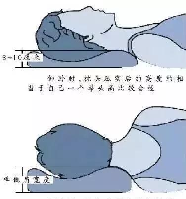 侧俯卧位睡眠示意图图片