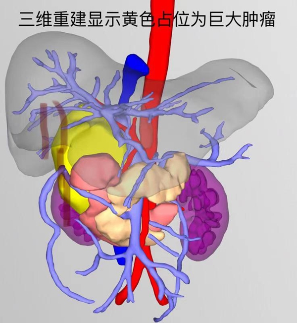 下腔静脉b超的解剖图图片