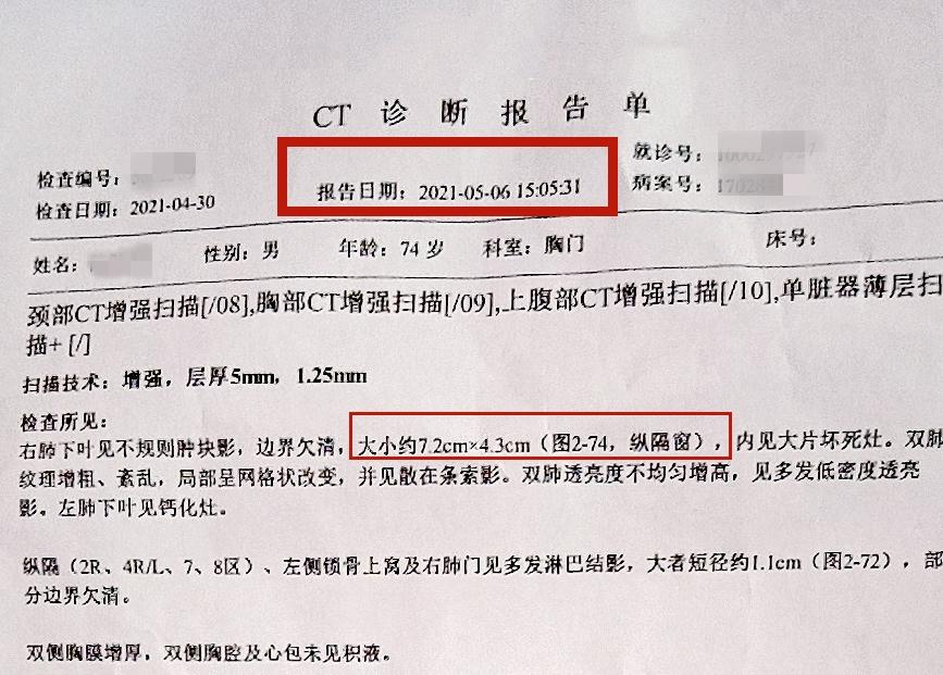 4月30日,陈先生因胸痛,痰中带血,到院就诊,ct报告显示右肺下叶不规则