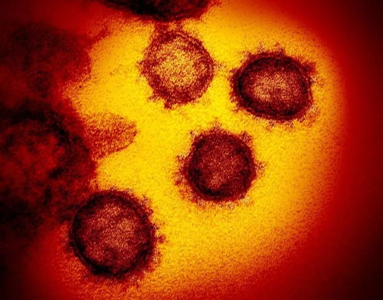 新冠病毒为什么不能叫“中国病毒”？看完这些你就懂了