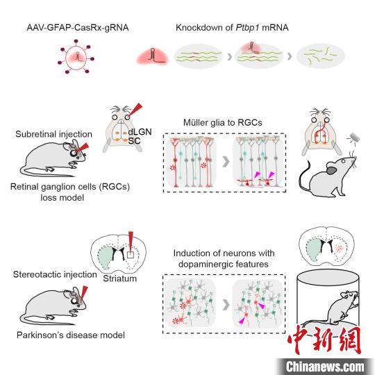 中国科研人员新研究为治疗青光眼、帕金森疾病等“探路”