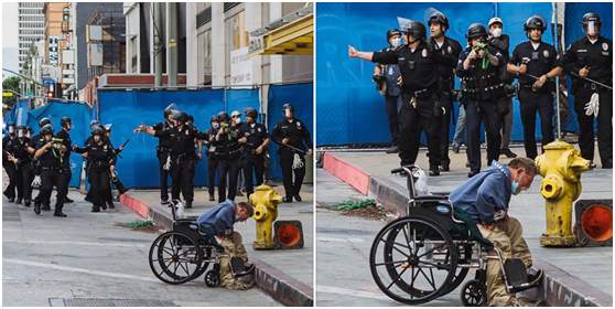 环球时报满脸是血，触目惊心！美国流浪汉遭警方橡皮子弹击中