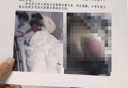 重庆一6岁女童因未完成作业被老师打伤住院  涉事教师称孩子没使劲哭以为不疼