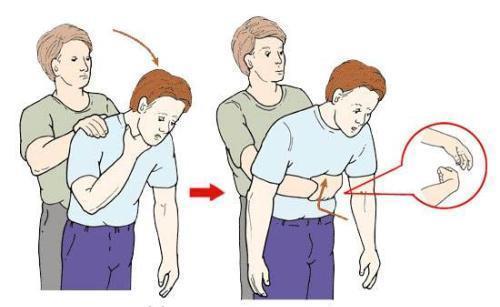 山東教師用海姆立克法救人這項急救法你瞭解多少