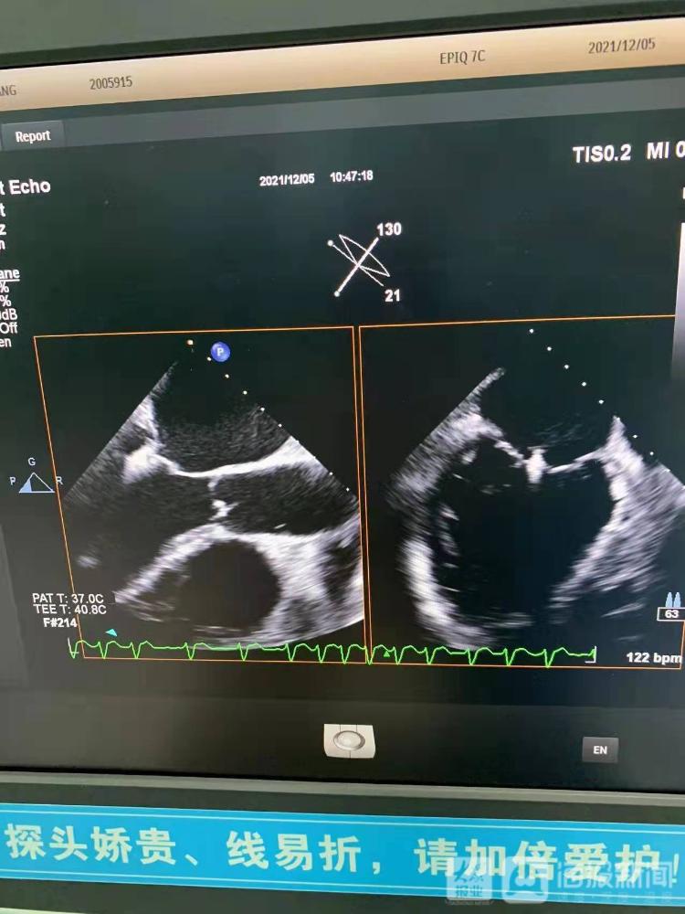 心脏超声检查报告单图片