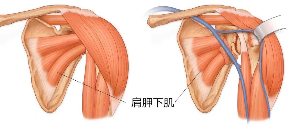 肩关节屈曲的肌肉图片