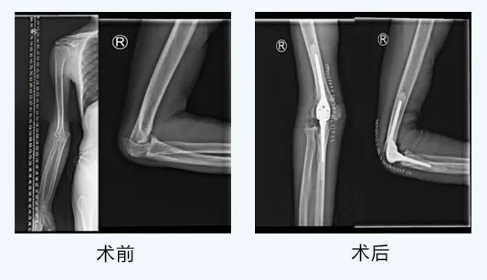 北京307医院、全国服务-收费透明网上代挂专家号，在线客服为您解答的简单介绍