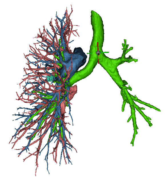 右肺支气管三维图图片